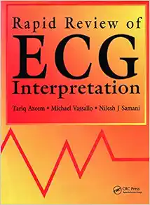 Rapid Review of ECG Interpretation (Medical Rapid Review Series) (EPUB)