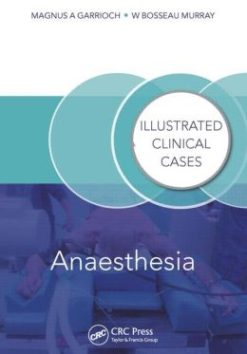Anaesthesia: Illustrated Clinical Cases