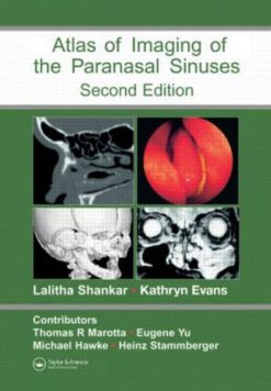 Atlas of Imaging of the Paranasal Sinuses, Second Edition (Original PDF from Publisher)