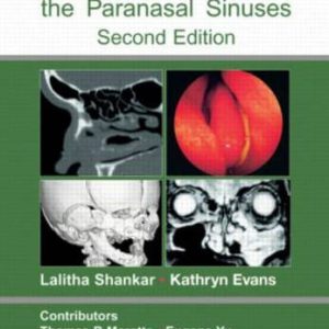 Atlas of Imaging of the Paranasal Sinuses, Second Edition (Original PDF from Publisher)