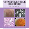Connective Tissue Disorders: An Atlas of Investigation and Management (Original PDF from Publisher)