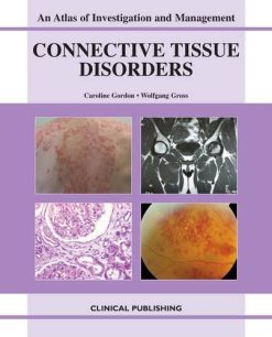 Connective Tissue Disorders: An Atlas of Investigation and Management (Original PDF from Publisher)