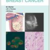 Breast Cancer: Visual Guide for Clinicians (Original PDF from Publisher)