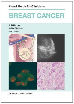 Breast Cancer: Visual Guide for Clinicians (Original PDF from Publisher)