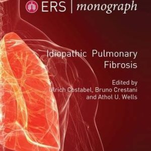 Idiopathic Pulmonary Fibrosis (ERS Monograph 71)