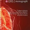 ERS Monograph 82 (Tuberculosis) (Original PDF from Publisher)