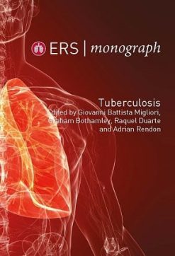 ERS Monograph 82 (Tuberculosis) (Original PDF from Publisher)