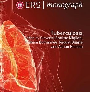 ERS Monograph 82 (Tuberculosis) (Original PDF from Publisher)