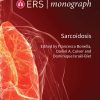 Sarcoidosis (EPUB)