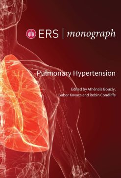 Pulmonary Hypertension (ERS Monograph 109) (EPUB)