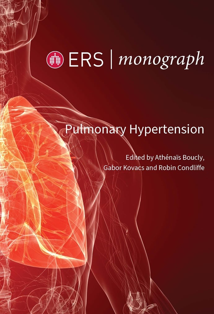 Pulmonary Hypertension (ERS Monograph 109) (EPUB)