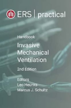 ERS Practical Handbook of Invasive Mechanical Ventilation, 2nd Edition (EPUB)