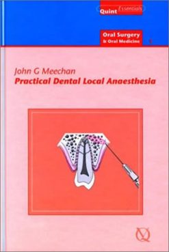 Practical Dental Local Anaesthesia (Oral Surgery) (EPUB)