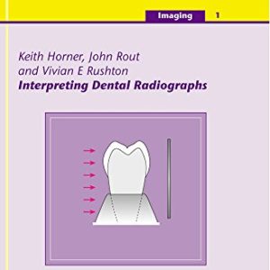 Interpreting Dental Radiographs (Imaging Vol. 1) (Quintessentials of Dental Practice) (Quintessentials: Imaging) (EPUB)