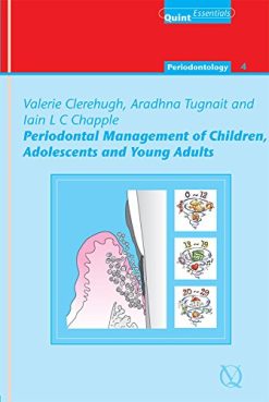 Periodontal Management Of Children, Adolescents, And Young Adults (Periodontology) (EPUB)