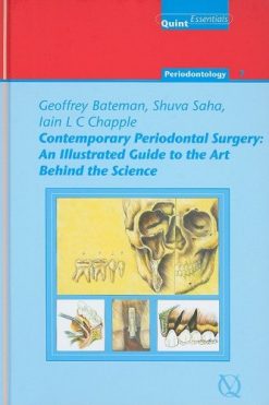 Contemporary Periodontal Surgery: An Illustrated Guide to the Art Behind the Science (Quintessentials of Dental Practice 21/ Periodontology) (Quintessentials of Dental Practice 21/ Periondontology) (EPUB)