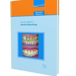 Dental Bleaching (Quintessentials of Dental Practice: Operative Dentistry 6) (EPUB)