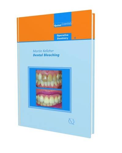 Dental Bleaching (Quintessentials of Dental Practice: Operative Dentistry 6) (EPUB)