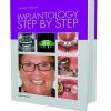 Implantology Step by Step (EPUB)
