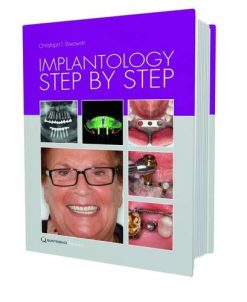 Implantology Step by Step (EPUB)