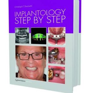 Implantology Step by Step (EPUB)