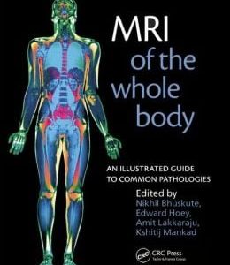 MRI of the Whole Body: An Illustrated Guide for Common Pathologies
