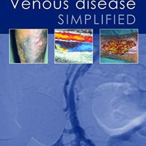 Venous Disease Simplified (Original PDF from Publisher)