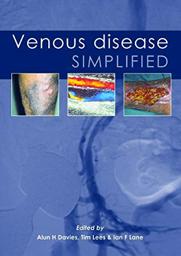Venous Disease Simplified (Original PDF from Publisher)