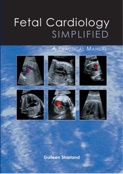 Fetal Cardiology Simplified (EPUB)
