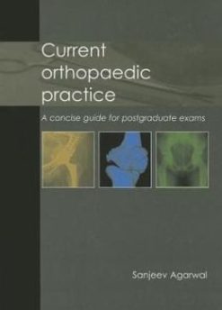 Current Orthopaedic Practice: A Concise Guide for Postgraduate Exams