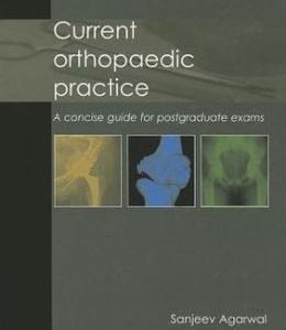Current Orthopaedic Practice: A Concise Guide for Postgraduate Exams
