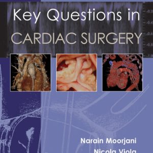 Key Questions in Cardiac Surgery (EPUB)