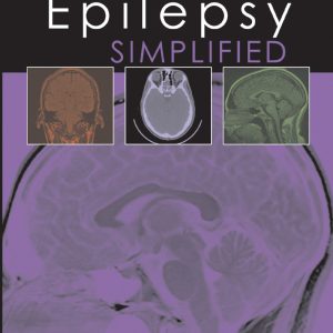 Epilepsy Simplified (EPUB)