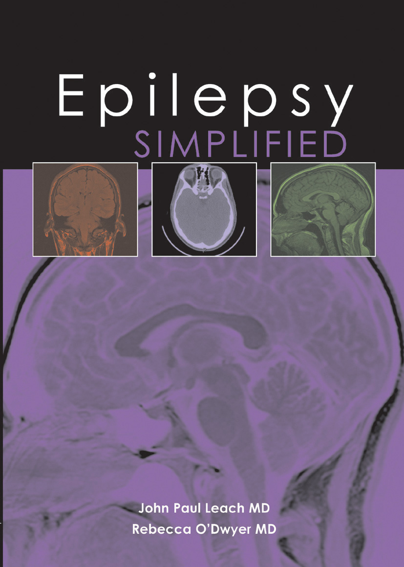 Epilepsy Simplified (EPUB)