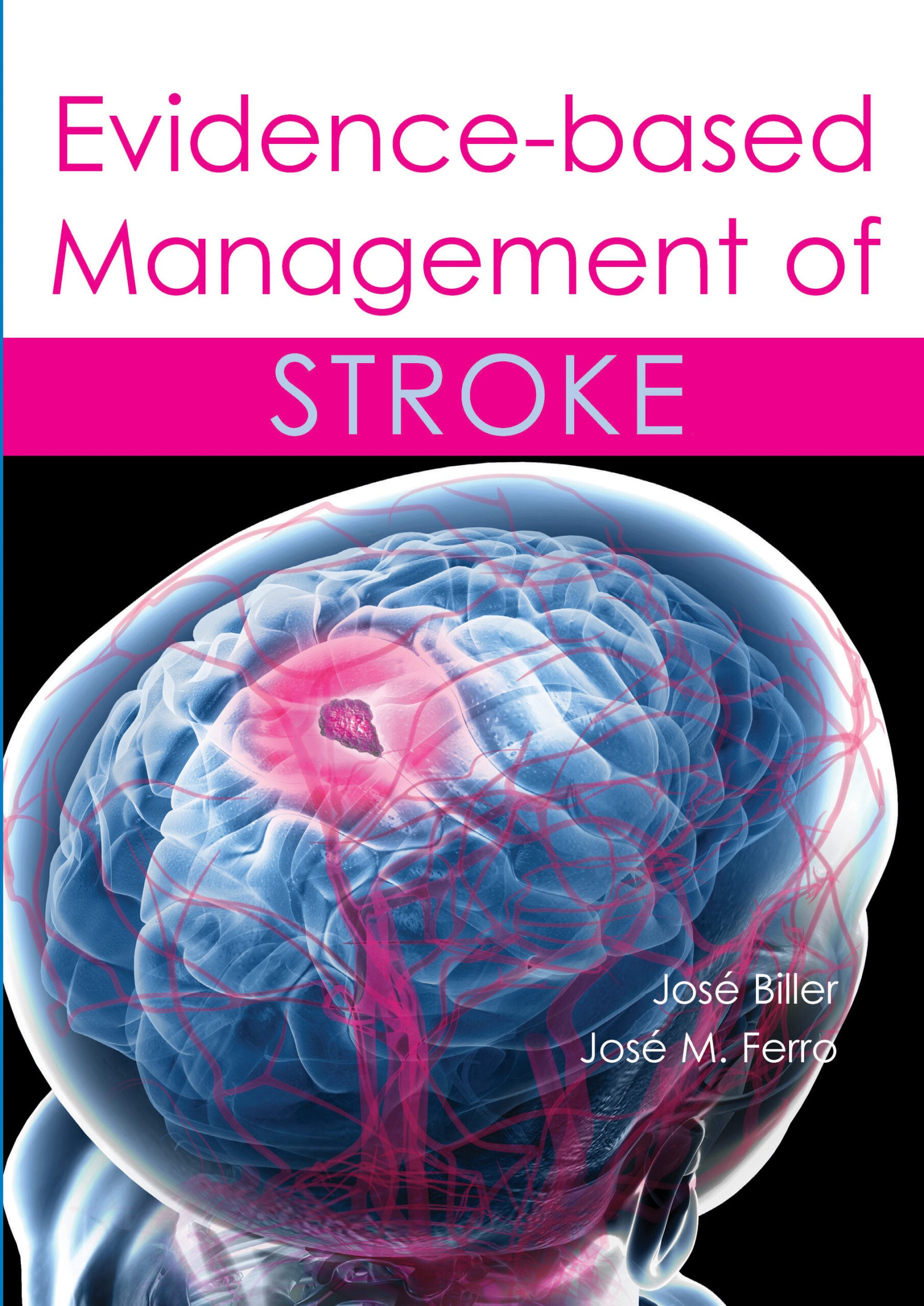 Evidence-based Management of Stroke (EPUB)