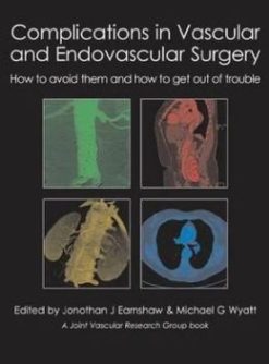 Complications in Vascular and Endovascular Surgery: How to Avoid Them and How to Get Out of Trouble