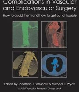 Complications in Vascular and Endovascular Surgery: How to Avoid Them and How to Get Out of Trouble