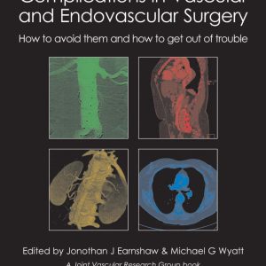 Complications in Vascular and Endovascular Surgery: How to avoid them and how to get out of trouble (EPUB)