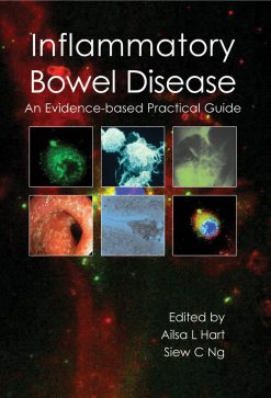 Inflammatory Bowel Disease (EPUB)
