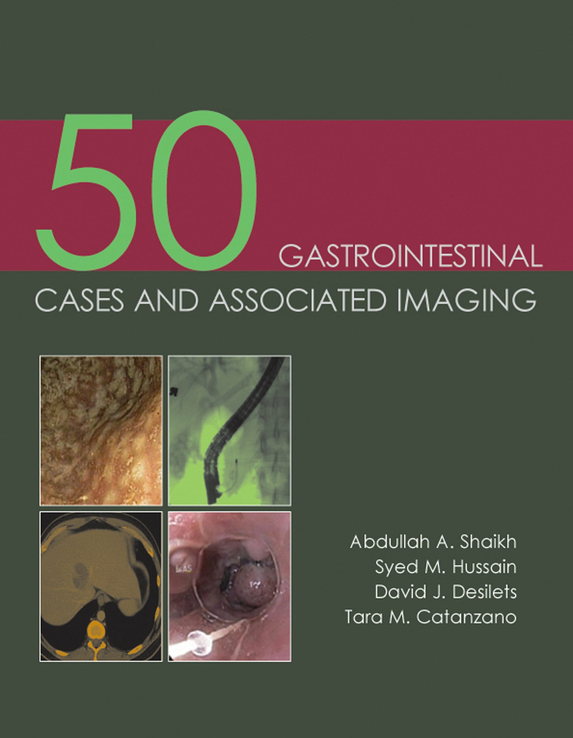 50 Gastrointestinal Cases and Associated Imaging (Original PDF from Publisher)