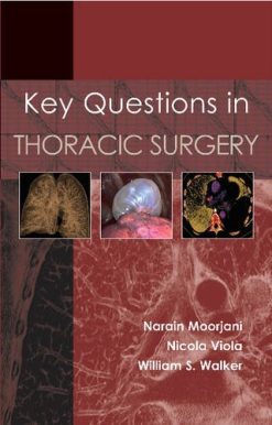 Key Questions in Thoracic Surgery (EPUB)