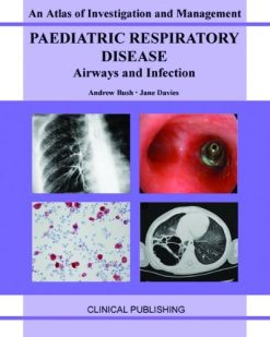 Paediatric Respiratory Disease- Airways and Infection: An Atlas of Investigation and Management (Atlases of Investigation and Management) (Original PDF from Publisher)