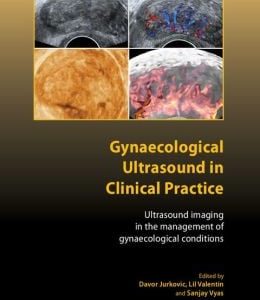 Gynaecological Ultrasound in Clinical Practice: Ultrasound Imaging in the Management of Gynaecological Conditions