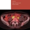 Gynaecological Oncology for the MRCOG and Beyond, 2nd Edition