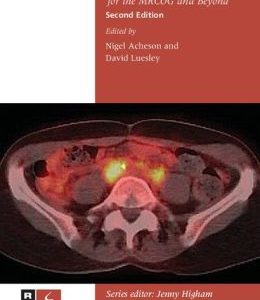 Gynaecological Oncology for the MRCOG and Beyond, 2nd Edition