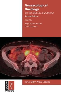 Gynaecological Oncology for the MRCOG and Beyond, 2nd Edition