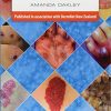 Dermatology Made Easy (Original PDF from Publisher)