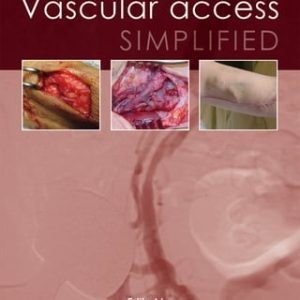 Vascular Access Simplified, 2nd Edition (EPUB)
