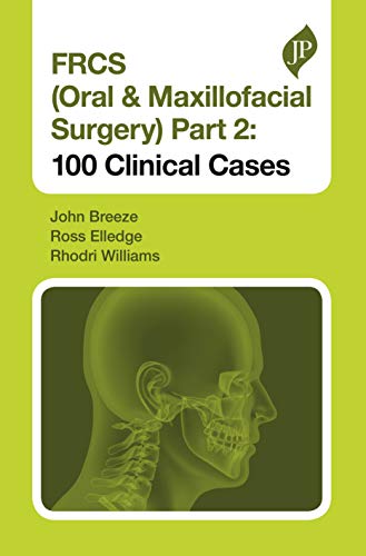 FRCS (Oral & Maxillofacial Surgery), Part 2 (EPUB + Converted PDF)