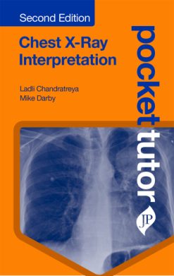 Pocket Tutor: Chest X-Ray Interpretation, 2nd Edition (Original PDF from Publisher)